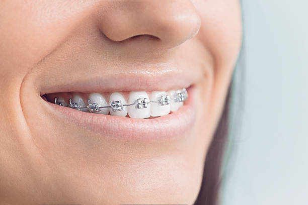 Best Invisalign and Clear Aligners  in Bigfoot, TX